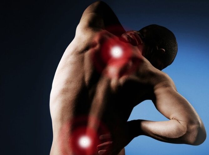 bolesť chrbta v dôsledku osteochondrózy chrbtice