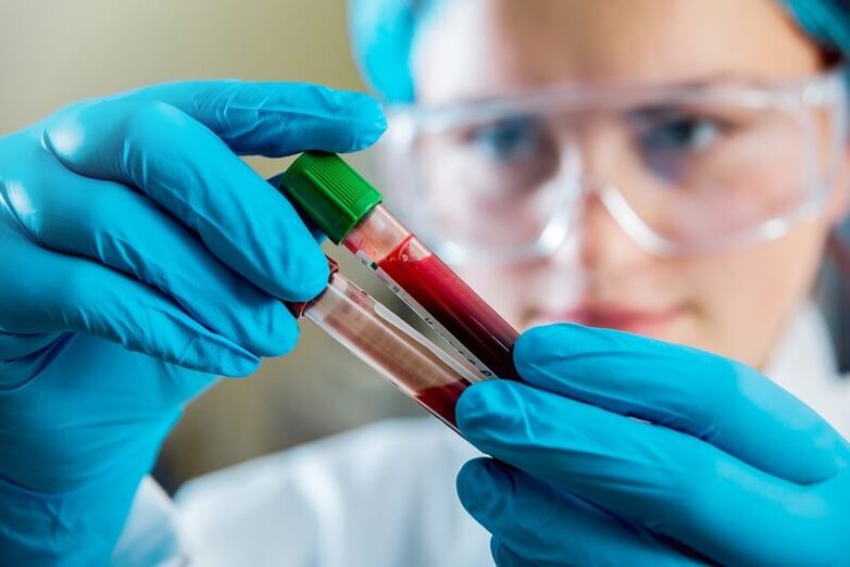 Kompletný krvný test na diagnostiku bolesti dolnej časti chrbta